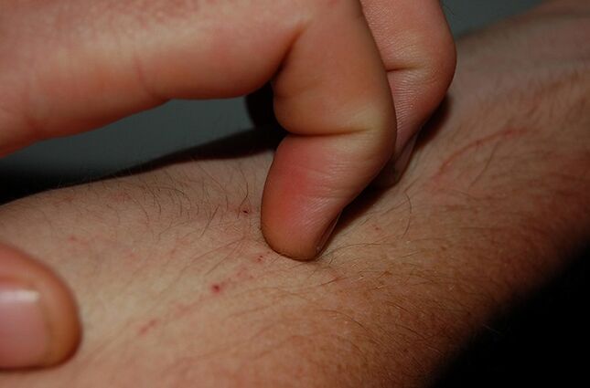 Itchy skin is a symptom of parasites