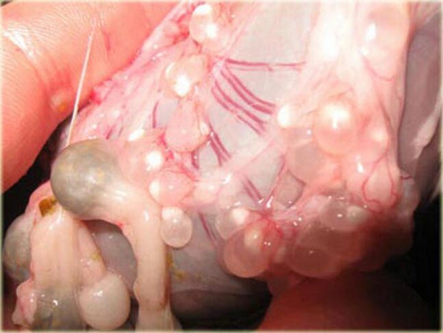 Hypodermic cysticercus larvae