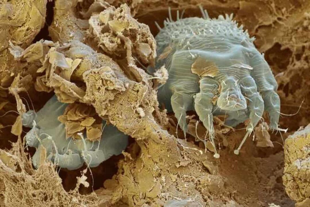 Scabies mites under the microscope