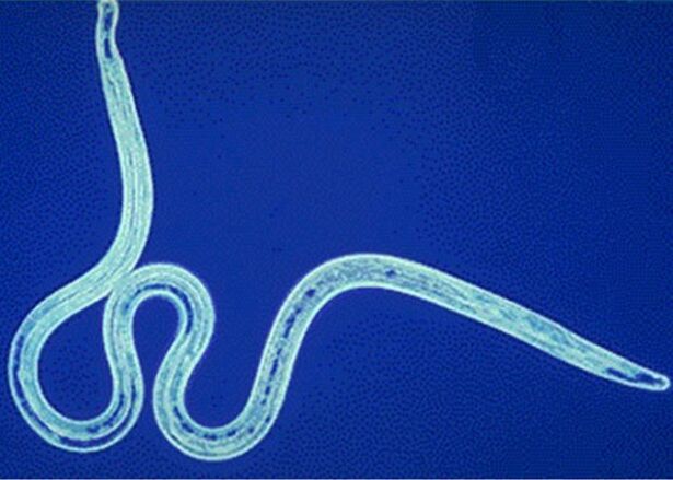 nematodes in humans