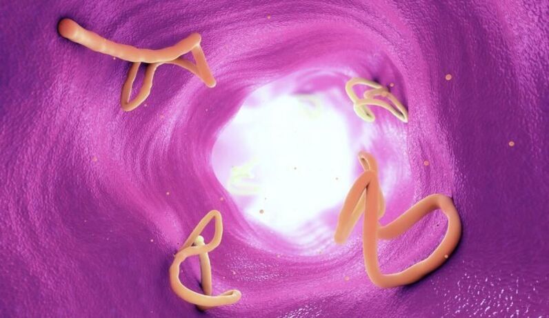 Worms in the human intestine