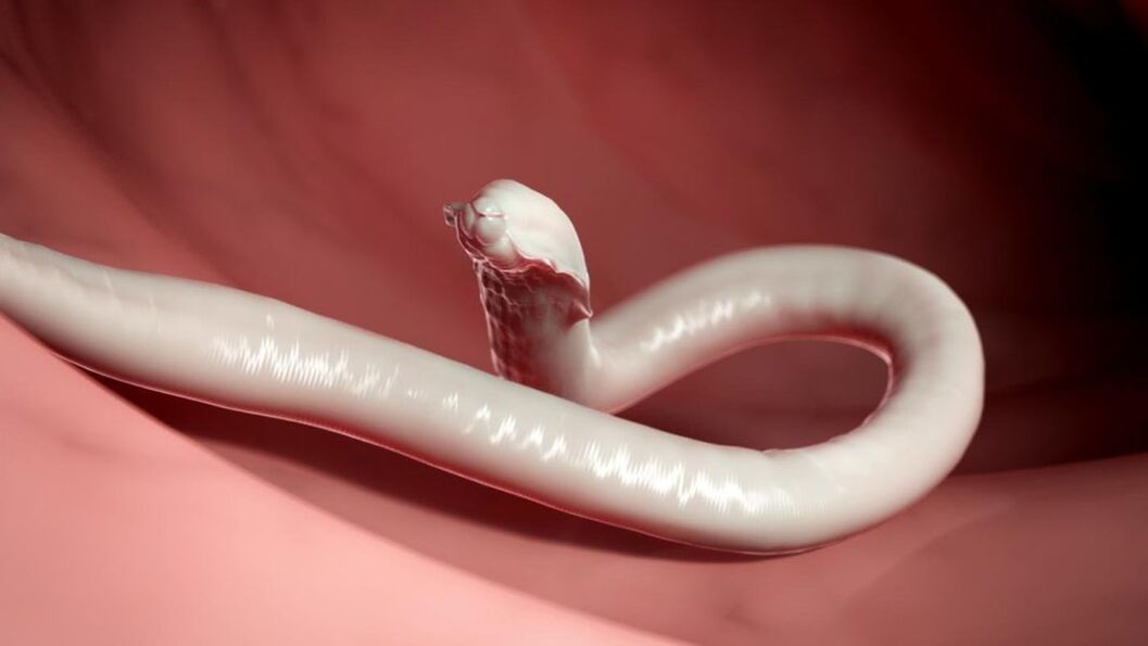 worms from human body
