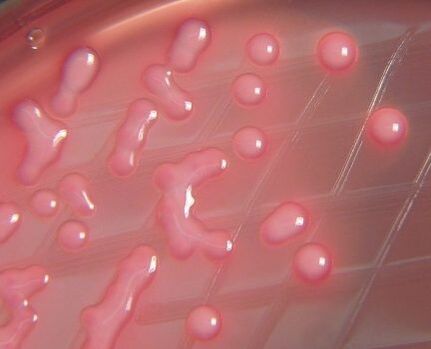 E. coli