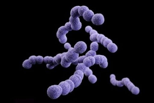 Streptococcus